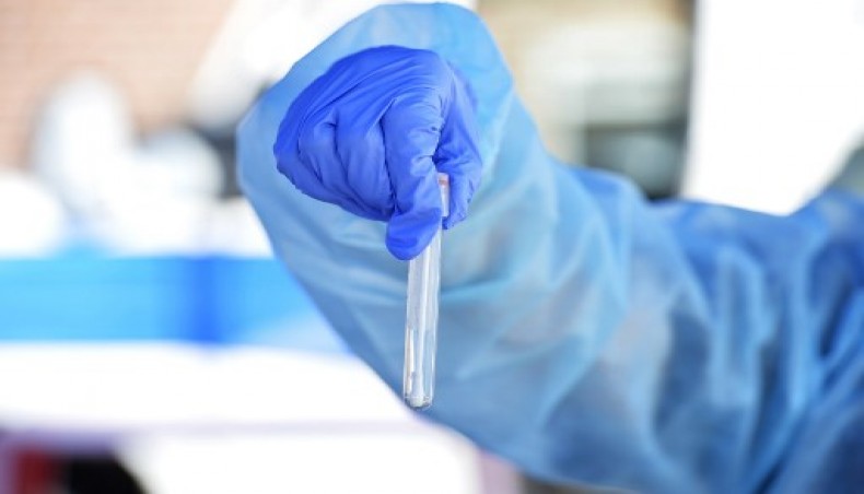 In this file photo a health worker holds up a test tube with a Covid-19 test sample taken from a person at Revere Beach in Revere, Massachusetts on August 11, 2020. - AFP photo
