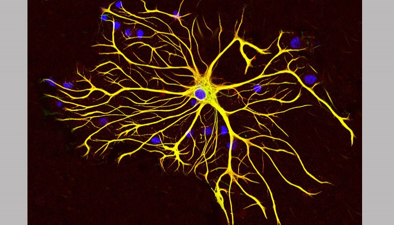 An astrocyte. — Wikipedia