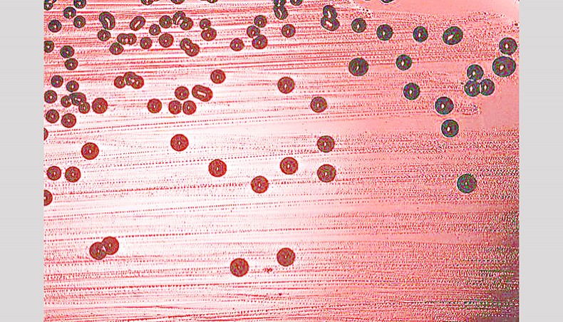 The first bacterial whole genome to be sequenced was of the bacterium Haemophilus influenzae. — Wikicommons