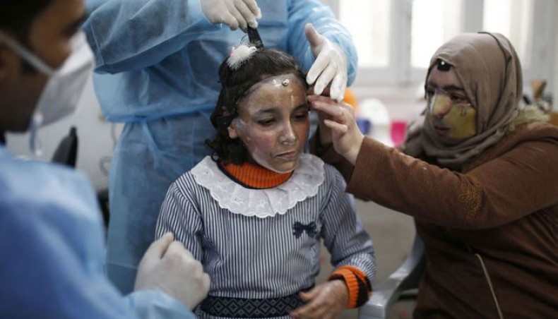 Palestinian Maram and her mother Izdihar al-Amawi suffering from severe facial burns get fitted with a 3D-printed transparent face mask at a clinic run by the doctors without borders international healthcare charity in Gaza City, on February 22, 2021. -- AFP photo