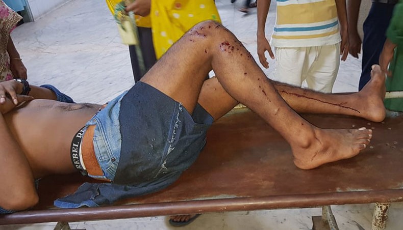A pellet-hit worker lies on a stretcher at Dhaka Medical College Hospital where he was brought after the police opened fire on garment workers leaving at least 20 workers injured in Gazipur on Monday demanding an extended Eid-ul-Fitr holiday. — New Age photo
